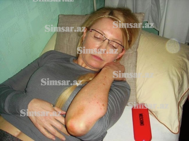 timosenko-muddetsiz-acligi-dayandirib